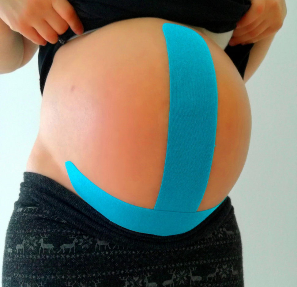 Šternberská nemocnice nabízí těhotným ženám i tejpování bříška