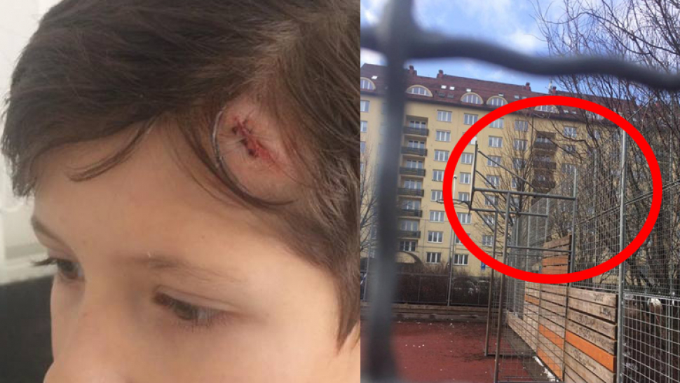 Železná tyč na zanedbaném městském hřišti rozbila dítěti hlavu. Přestupek, řekla policie